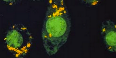 Бактеріофаги проти мікобактерій, фаготерапія туберкульозу